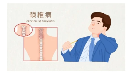 Sobre l'insomni? Has considerat la causa de la columna cervical?