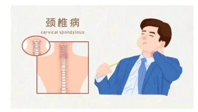 Sobre l'insomni? Has considerat la causa de la columna cervical?
